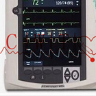 Máy hỗ trợ tim 12 inch, Máy sốc điện cho người lớn được sử dụng cho tim
